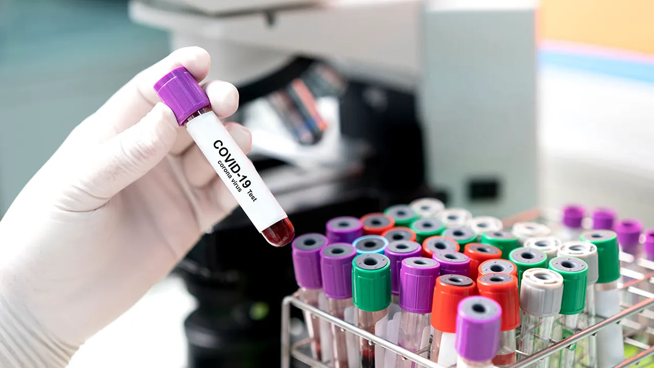 (P) Tot ce trebuie să ştii despre testul molecular PCR pentru detectarea coronavirusului


