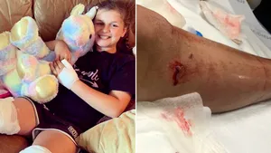 Momente înfiorătoare! O fetiţă a fost nevoită să se lupte cu un rechin pentru a scăpa cu viaţă: ”Era plină de sânge”