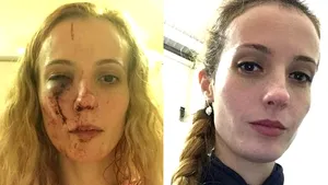 ROMÂNCĂ bătută cu bestialitate în Marea Britanie de o bandă de adolescenţi pentru că 