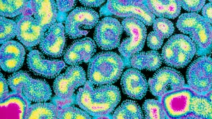 Numărul cazurilor de infecţii respiratorii, în creştere. Un deces nou raportat