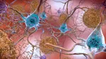 Un virus obişnuit ar putea declanşa boala Alzheimer