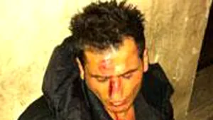 Aşa arăta chelnerul din Firenze, imediat după ce a fost bătut de Adrian Mutu - FOTO