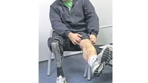 Campionul infirm şi statul şchiop