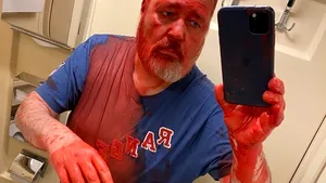 Un jurnalist rus a fost atacat în tren: „Au turnat vopsea pe bază de ulei şi acetonă. Ochii mă ustură îngrozitor”