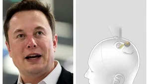 Lupta pentru cipurile din cap. Un rival al companiei lui Elon Musk pregăteşte testarea unui implant cerebral