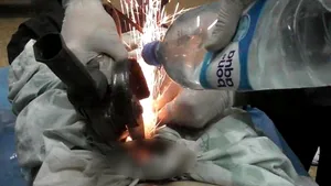 Un bărbat a ajuns la urgenţe după ce soţia i-a pus pe organul genital o piuliţă uriaşă. Operaţiunea de salvare, foarte dificilă | FOTO