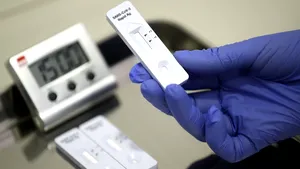 Testele antigen ar putea fi mai eficiente decât cele PCR pentru a stopa răspândirea SARS-CoV-2