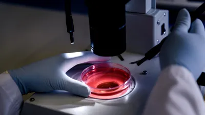 SĂNĂTATE Primul esofag creat în laborator. Copiii cu malformații ar putea primi un organ crescut din propriile celule