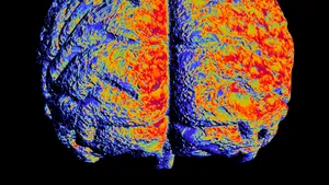 În câţiva ani, boala Alzheimer va putea fi depistată printr-un test de sânge