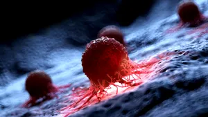 Un progres important ]n lupta cu cancerul: O nouă terapie care elimină tumorile, aflată în studii preclinice