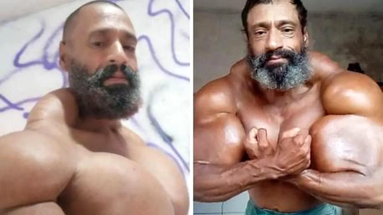 Culturistul Valdir Segato, care îşi deformase corpul, a murit: şi-a injectat ulei Synthol şi alte substanţe pentru umflarea muşchilor

