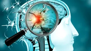 Care sunt efectele COVID-19 asupra sistemului nervos al pacienţilor. Cele mai dese afecţiuni, explicate de un neurolog