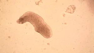 Alerta sanitară în India după creşterea numărului de cazuri de amoebă „mâncătoare de creier