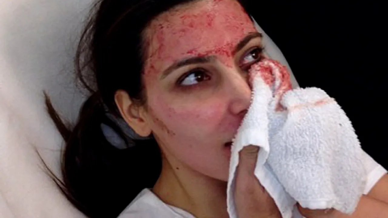 Kim Kardashian, tratament facial inedit pentru care a folosit propriul sânge - FOTO