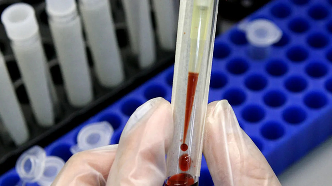 Agenţia Antidoping: Chiar şi la snooker am găsit dopaţi, fotbaliştii nu vor teste