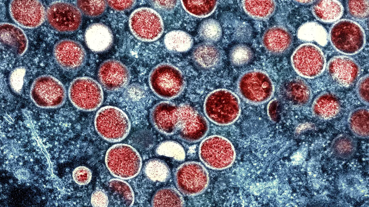 Gripa tomatelor. Apariţia unei noi infecţii virale rare, care afectează copiii mici, a determinat autorităţile sanitare să emită un avertisment de sănătate