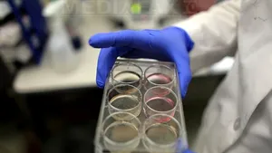 Microfibre impregnate cu celule, folosite pentru reconstrucţia ţesuturilor vii