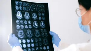 Studiu: Simptomele menopauzei ar putea semnala riscul de demență