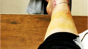 Medic, către o rănită în accident: Ce dracu' porţi sutien, dacă tu ai silicoane?