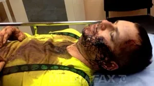 Kievul afirmă că opozantul Dmitro Bulatov nu a fost torturat