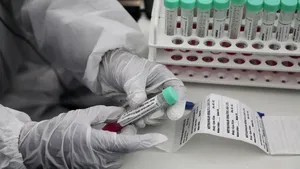 Noi speranţe din Israel. Dovezi care arată eficacitatea a două medicamente minune pentru Covid-19. Ce sunt EXO-CD24 şi Allocetra