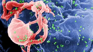 Poate un vaccin anti-HIV să genereze un răspuns imunitar eficient? 
