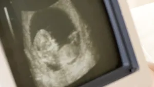 Statul cu cea mai DURĂ legiferare din lume. Aici avortul este ASPRU pedepsit: 13 femei au făcut închisoare