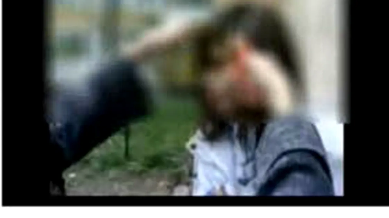 Arsă cu ţigara pe faţă pentru că a vrut să 