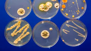 Concluziile anchetei epidemiologice: E.Coli în probele de alimente şi apă de la domiciliu, în cazul morţii fetiţei de 3 ani din Iaşi