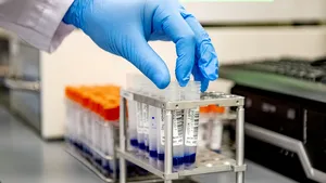 Două noi decese din cauza coronavirusului în România. Bilanţul ajunge la 94