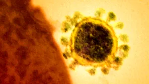 Comisia Europeană anunţă că statele membre ale UE nu au raportat cazuri de coronavirus