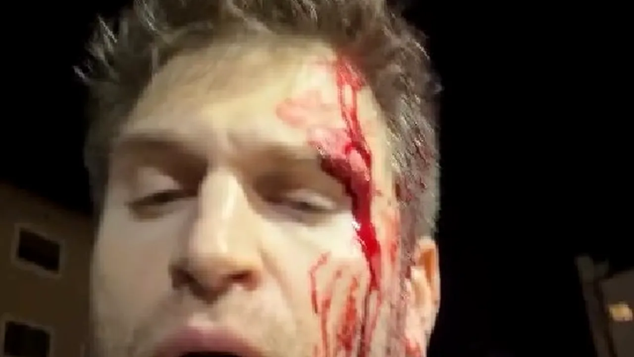 Keegan Allen, actorul din „Pretty Little Liars”, jefuit sub amenințarea armelor la Los Angeles. A fost lovit cu un pistol pentru ceasul său