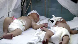 Romania Transplant Auth Urges Health Min To Scarp Ban On Assisted Human Reproduction
