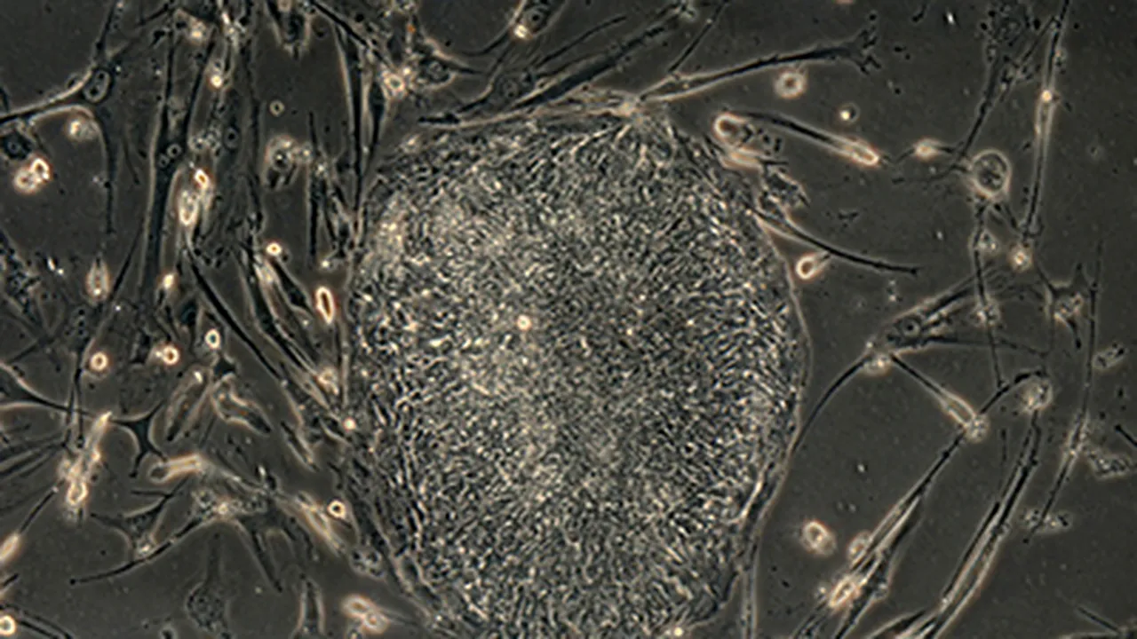 Romanian MedLife Starts Stem Cell Collection Operations