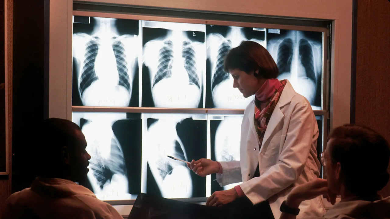 Asociere între un gigant tehnologic şi compania Bayer. Va fi creat un nou produs de inteligenţă artificială pentru radiologi