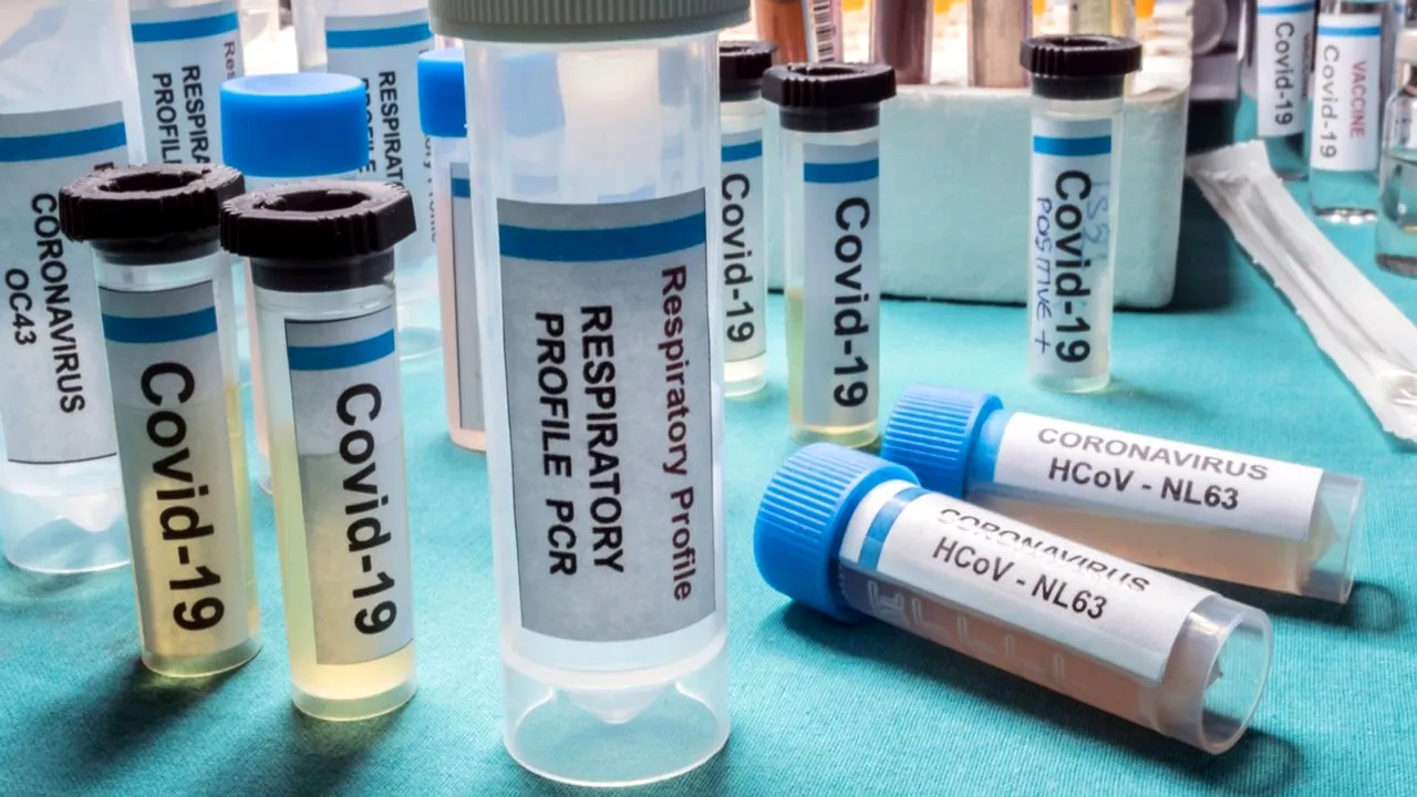 Dexametazona ar putea genera riscuri pentru pacienţii cu forme uşoare ale noului coronavirus