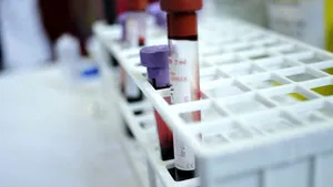 Bucharest Blood Transfusion Center Staff Protested Friday Over 30% Wage Cut