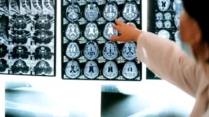 Stop acestor trei obiceiuri care îți distrug mintea - neurolog de top