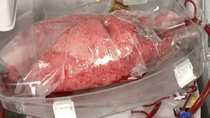 Serviciul de Ambulanţă Bucureşti-Ilfov poate derula în continuare activitatea de transplant