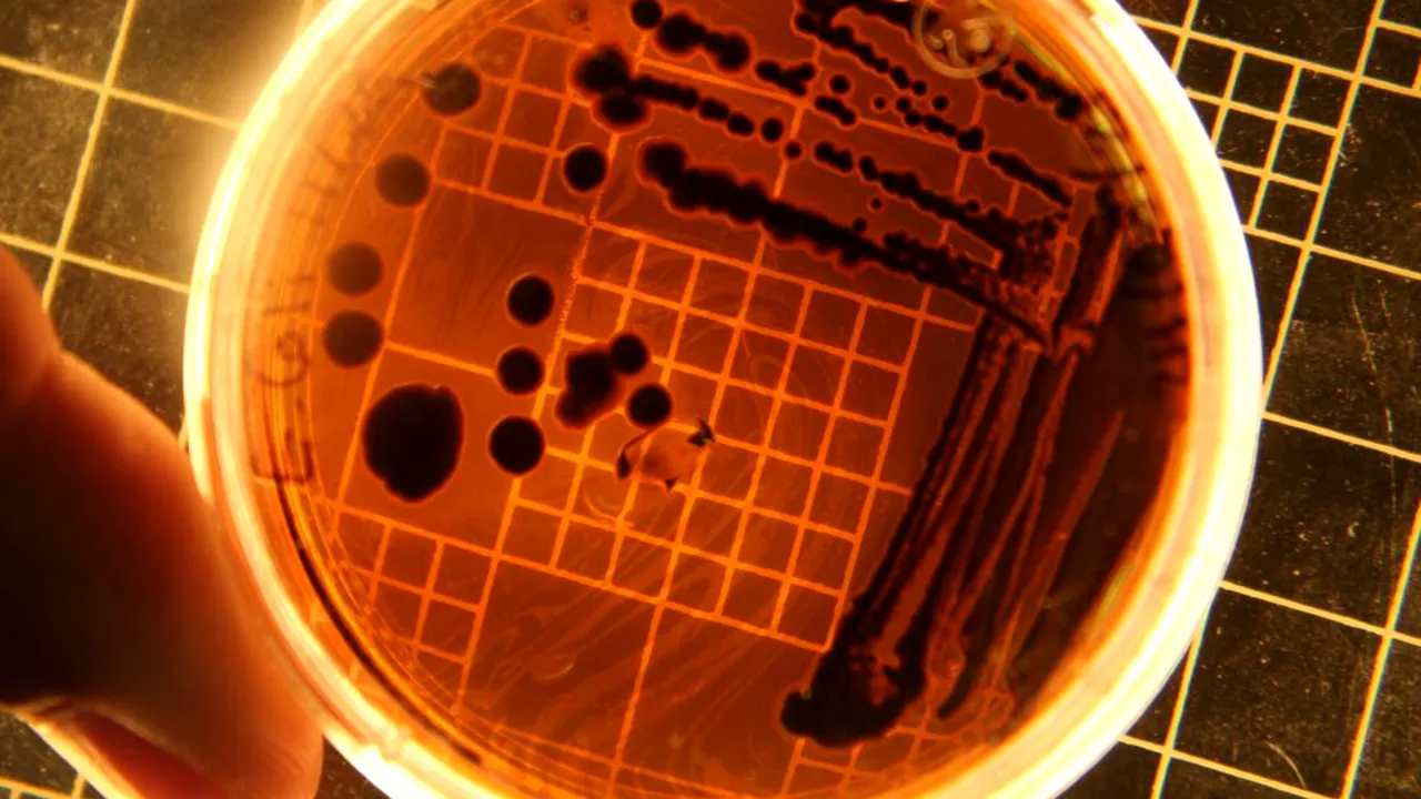 Speranță împotriva infecțiilor rezistente: virusurile care ucid bacterii