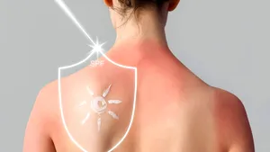 Evită arsurile solare: Cum alegi SPF-ul potrivit? (P)