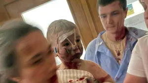 Consiliul de Securitate ONU se va reuni marţi, după atacul de la Kiev