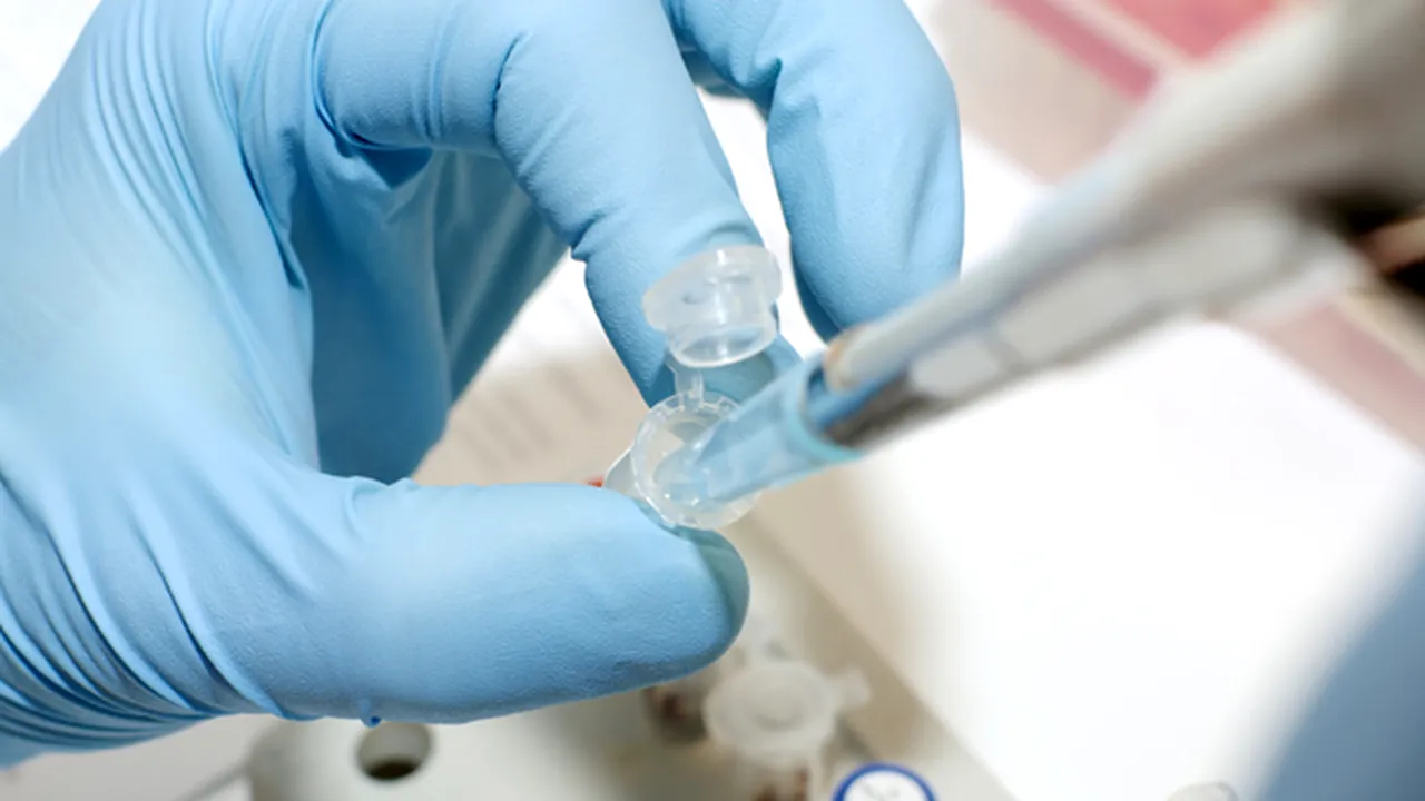 Un vaccin experimental împotriva cancerului de piele a redus cu 44% riscul de deces 