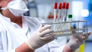 Coronavirus: Experţii americani spun că virusul se poate răspândi prin vorbire sau chiar prin respiraţie
