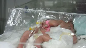 O tânără a născut SIAMEZE la Spitalul Judeţean Constanţa. Fetiţele au fost transferate la Spitalul 