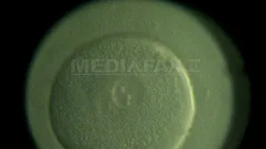 Lista alimentelor care scad şansele ca un bărbat să devină tată