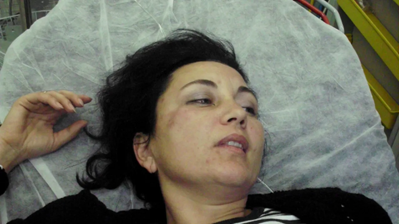 Bistriţa: Consilier judeţean PDL, la spital după ce a fost lovit cu pumnul în timp ce făcea campanie - FOTO