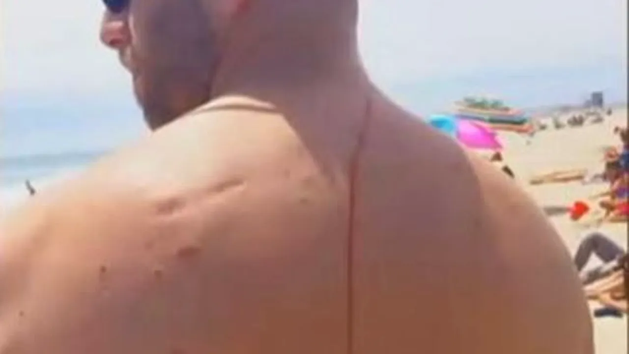 INSOLIT: Atacul unui rechin a salvat viaţa unui american -  VIDEO