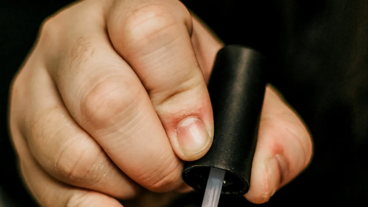 Semnul de pe unghie care poate sugera cancerul: atenţionări despre melanomul unghial