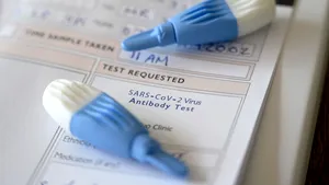 STUDIU. O treime din persoanele contaminate cu virusul sunt asimptomatice. Anunţul guvernului ţării cu peste 241.000 de cazuri de COVID-19